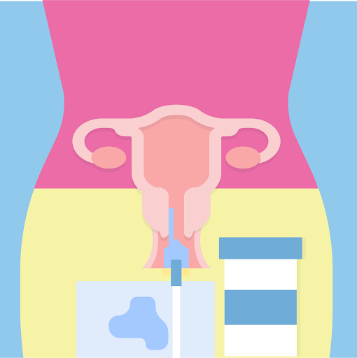 What You Should Know About Your Pap Smear Test