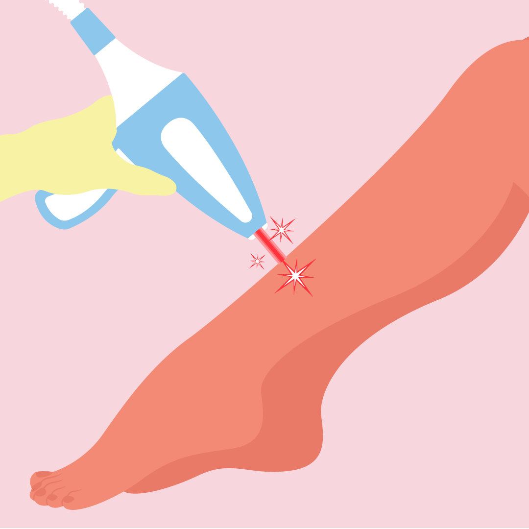 The Science Behind Laser Hair Removal: How Does it Work?