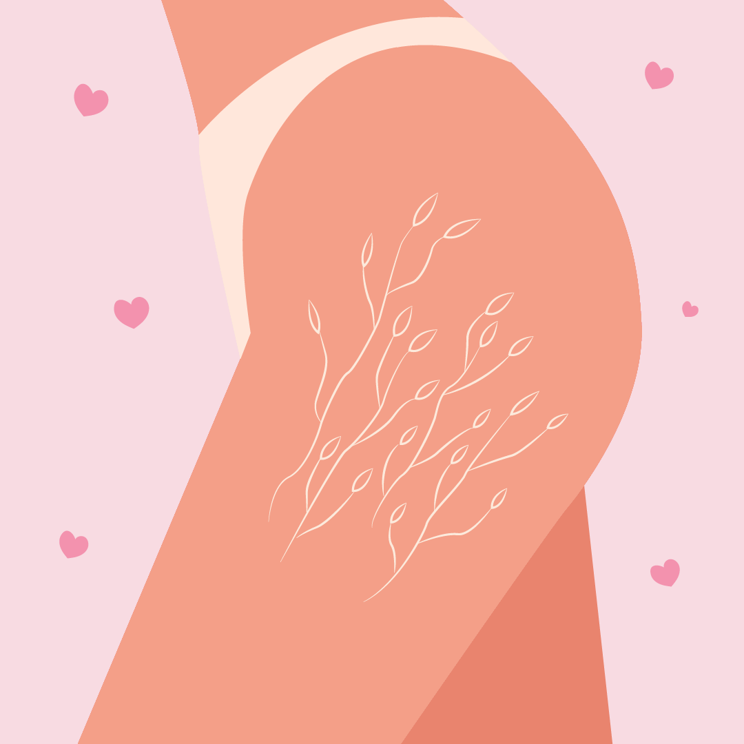 Stretch Marks: A Natural Part of Life's Journey
