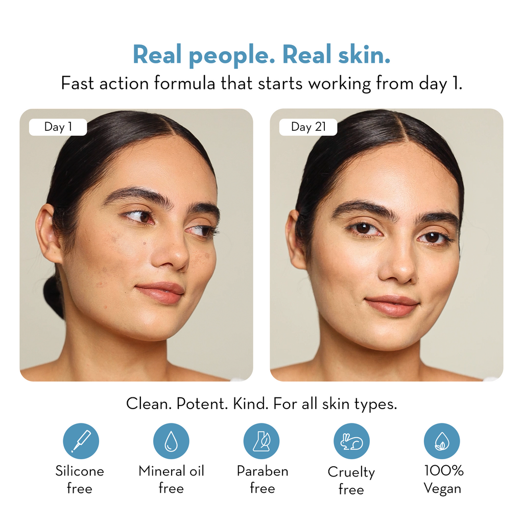 Beat The Blues Moisture Surge Cream